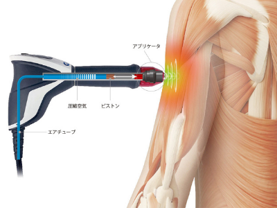 ショックマスター - 仙台市若林区のいしづか接骨院（Plus